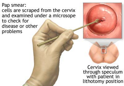 Pap Smear